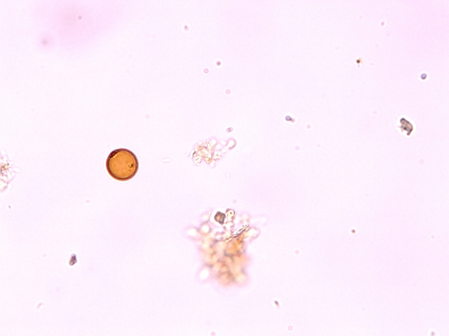 lepocinclis